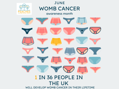 36 pairs of knickers with one highlighted in yellow